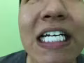 因要回国，转让时下最火牙齿美白贴面全套器械及耗材