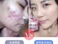 ❤招商招代理只需一支手機去到哪都可賺取收入