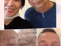 皮膚治療