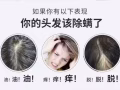 控油，除蟎，修復受損頭髮還你青春！