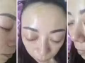 韩国水光针，保证一次见效