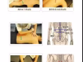 原始点推拿，主治，偏头痛， 头痛， 颈椎病 ，胃病，腰疼，腰间盘突出，妇科，