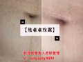 难治的皮肤问题找我祛斑洗纹身祛疤痕牛皮癣湿疹妊娠纹祛皱冰点脱毛祛胎记洗眉痘坑祛痘