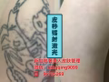 难治的皮肤问题找我祛斑洗纹身祛疤痕牛皮癣湿疹妊娠纹祛皱冰点脱毛祛胎记洗眉痘坑祛痘