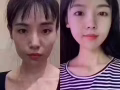 为庆祝韩式微整公司成立12周年大促销哦