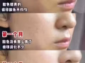 為慶祝韓式微整公司成立12周年大促銷哦