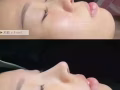 韩式微整新年大促销咯
