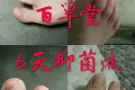 特效脚气水，灰指甲，狐臭粉，祛痘膏，鼻炎膏，