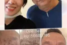 皮肤治疗