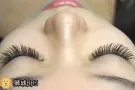 针对普通上班族的睫毛嫁接