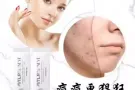 美白，护肤