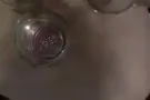 按摩 拔罐 推油减肥