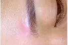 不流x,恢复期短,技术好，纹眉，纹唇，美瞳线