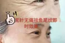 额头祛皱， V脸提升,祛除川子纹，丰太阳穴，丰额头等