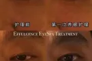 招聘 爱眼净助理老师月薪$4000-10000统一培训 有无经验即可