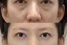 韩式微整圣诞大促销了