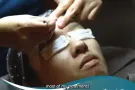 有效改善；痤疮，痘坑痘印，改善皮肤暗黄|效果巨好！看到就是赚到，时间有限哦