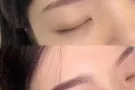 美容美体养生 点痣脱毛
