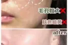 专业机打水光！无效不收费！价格优惠！