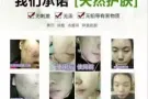 唯尚颜祛痘膏多少钱？怎么辨别是否真品？