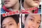 靠唯尚颜祛痘膏治好痘痘是啥心情吗？