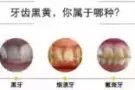 美牙仪
