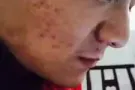 英树护肤品让你拾回自信