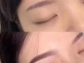 美容美體養生 點痣脫毛