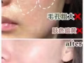 专业机打水光！无效不收费！价格优惠！