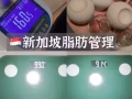 拔罐减肥$28 - 一次见效！