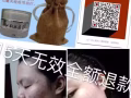 祛痘膏專治痘痘，痘印，美白，控油，承諾15天無效全額退款。