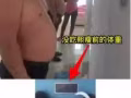 熙瘦减肥塑型 !独家代理！！月瘦8️⃣-2️⃣5️⃣斤，无效退款我买单