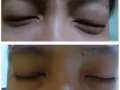 田七袋袋消去除眼袋！去除黑眼圈！就是这么简单 【三分钟见效】