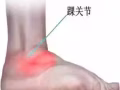 針對關節炎、頸椎病、耳療、足部矯正、脊椎矯正.....