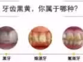 美牙儀